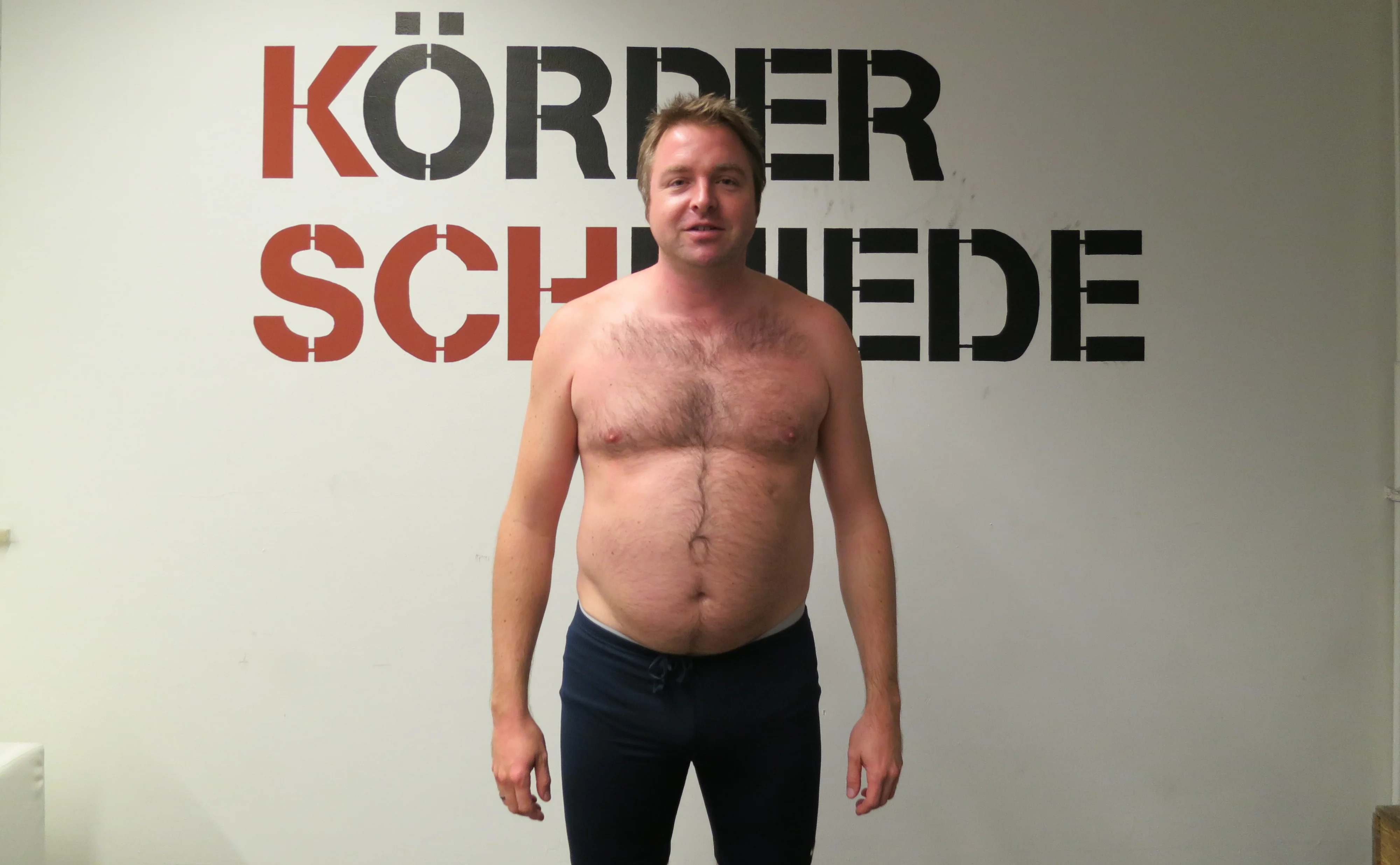 Michael – Vorher